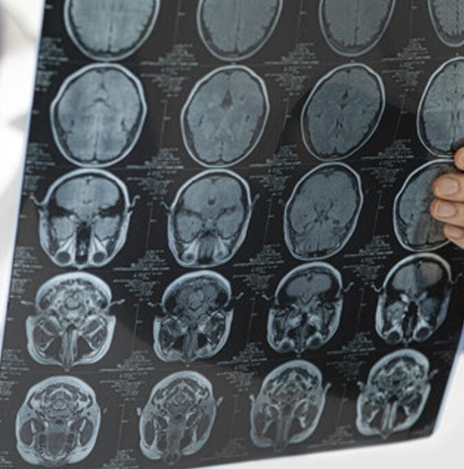 Procedimentos Realizados